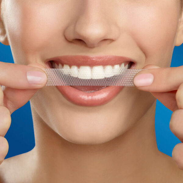 Crest 3D Whitestrips ($5 Rebate Eligible) Brilliance White Teeth Whitening Kit, 16 Treatments, Item# BLO12774